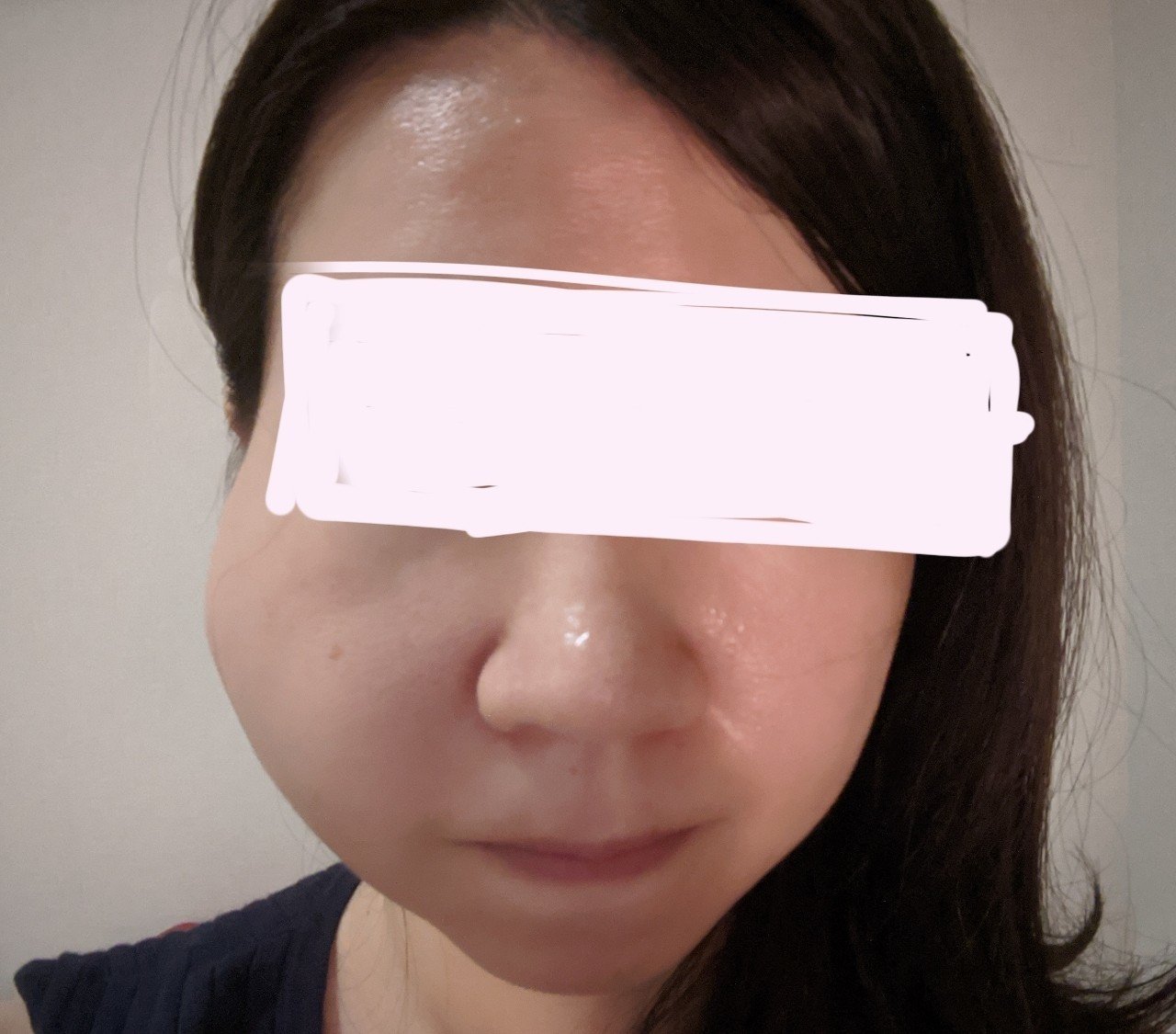 腺 耳 炎 大人 下