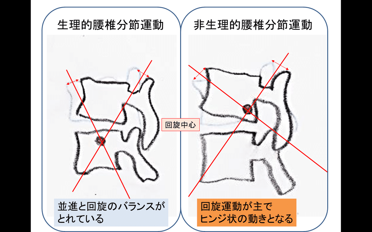 脊椎の分節的安定性のための運動療法 脊椎不安定症 【鍼灸師が執筆・監修】
