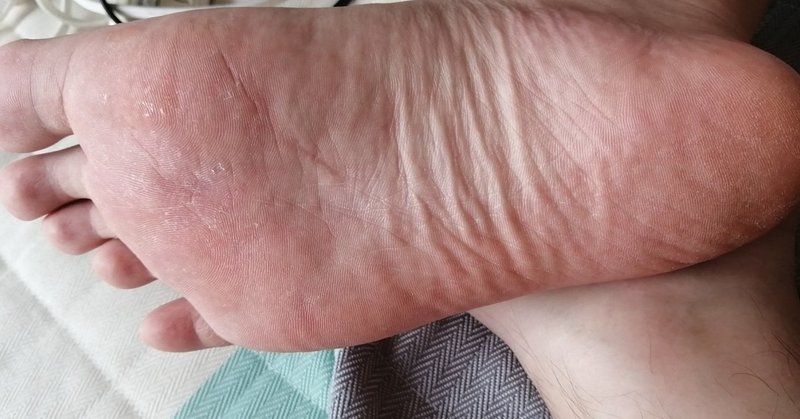 今日の足裏フェチ日記 1日目 キャラクター界通信 Note