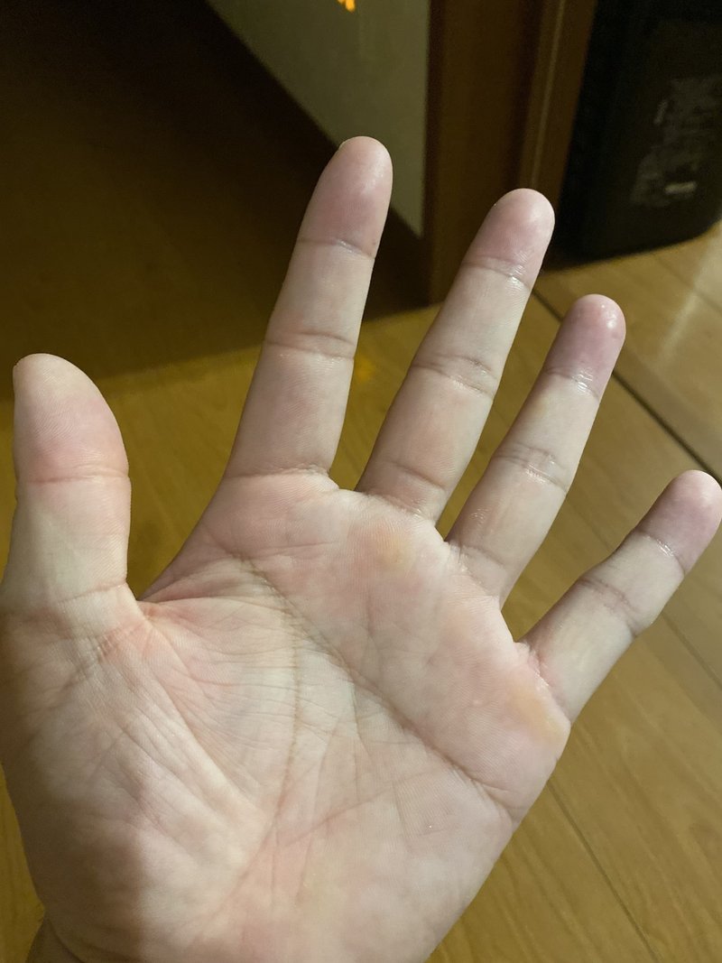 天下より早く進め 私の手相あり まる48社長 Note