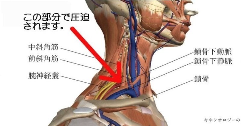 斜角筋 の新着タグ記事一覧 Note つくる つながる とどける 斜角筋 の新着タグ記事一覧 Note つくる つながる とどける