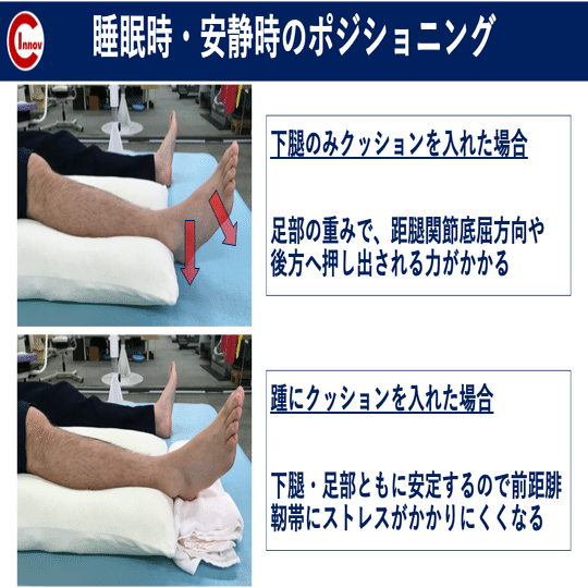 捻挫に対する評価 アプローチ 須藤 慶士 わかりやすい足部評価 Note