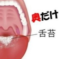 膿栓 臭い玉 を除去したい 取り方のコツと予防方法は Uebayashi Note 膿栓 臭い玉 を除去したい 取り方のコツと予防方法は Uebayashi Note