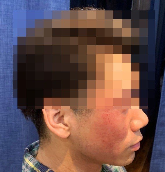 アトピーに悩む方へ Ko Ji Note