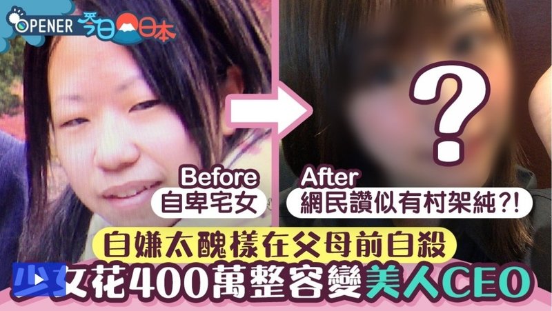 不細工な少女が整形をして発信していたら メディアに取り上げられて海外でも話題になり テレビに出ることになった話 みきしぃ Note