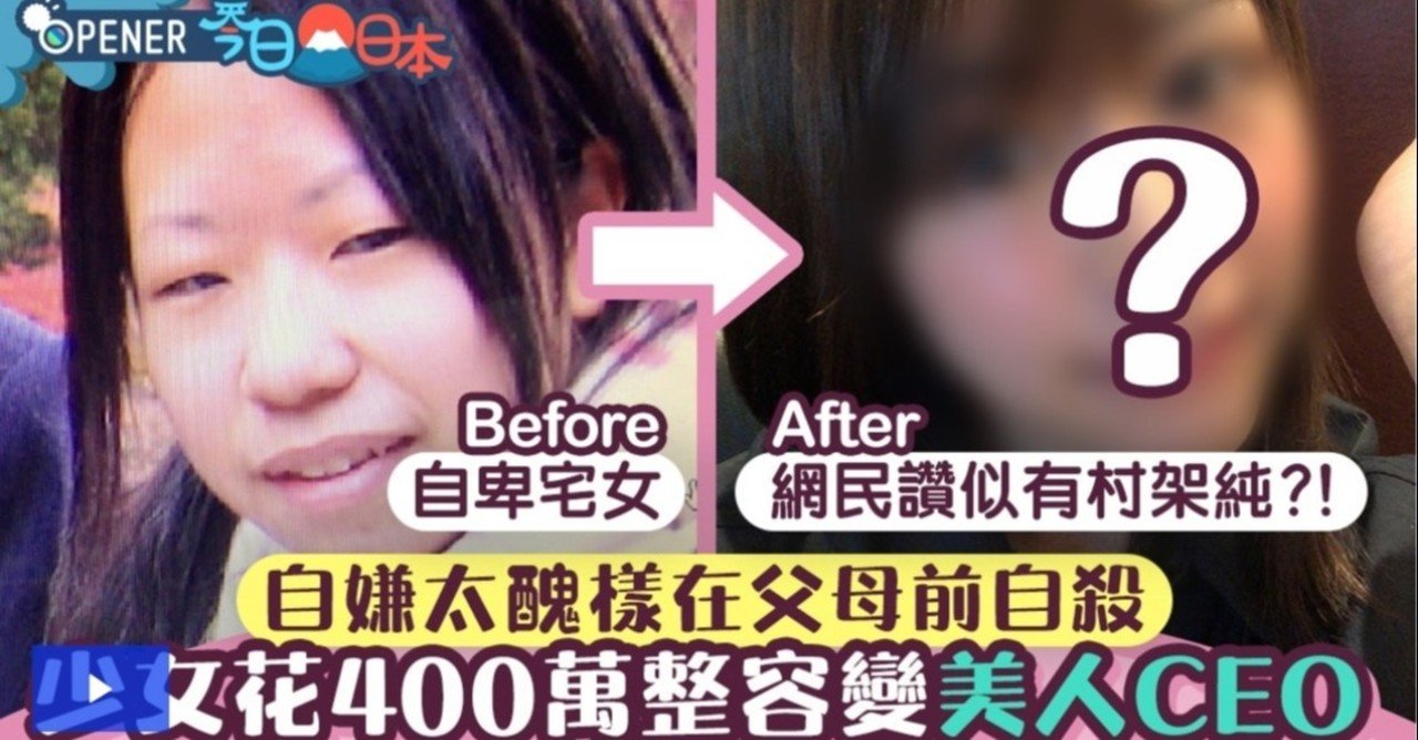 不細工な少女が整形をして発信していたら メディアに取り上げられて海外でも話題になり テレビに出ることになった話 みきしぃ Note