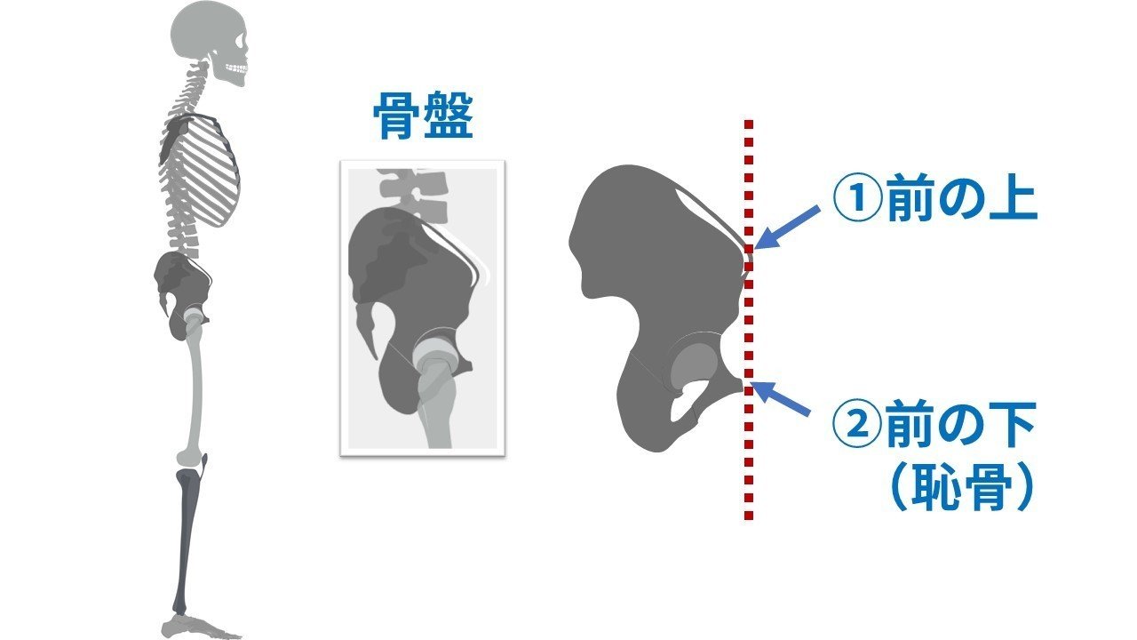 あなたは本当に反り腰 これ間違えると大変です 1分でできる反り腰チェック 理学療法士キリツ シセトレ 姿勢クリエイター Note