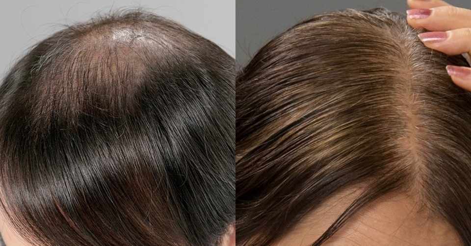 ビタブリッドcヘアーの口コミ評判と効果的な使い方やお得な購入方法 春 Note