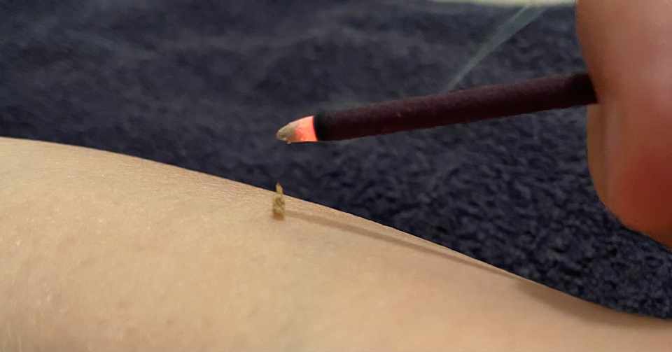 火傷にはあのアロマ N Miyawaki Note