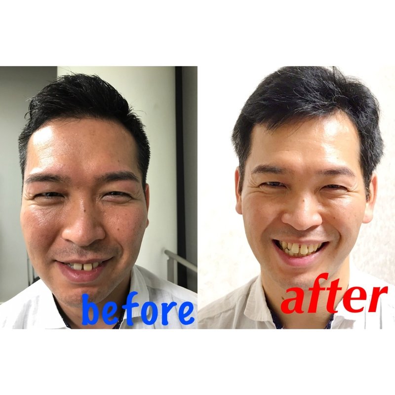 解決したいコンプレックス 解決しようと全然思わないコンプレックス 笑顔表情筋協会 笑顔トレーナー 手塚規雄 Note