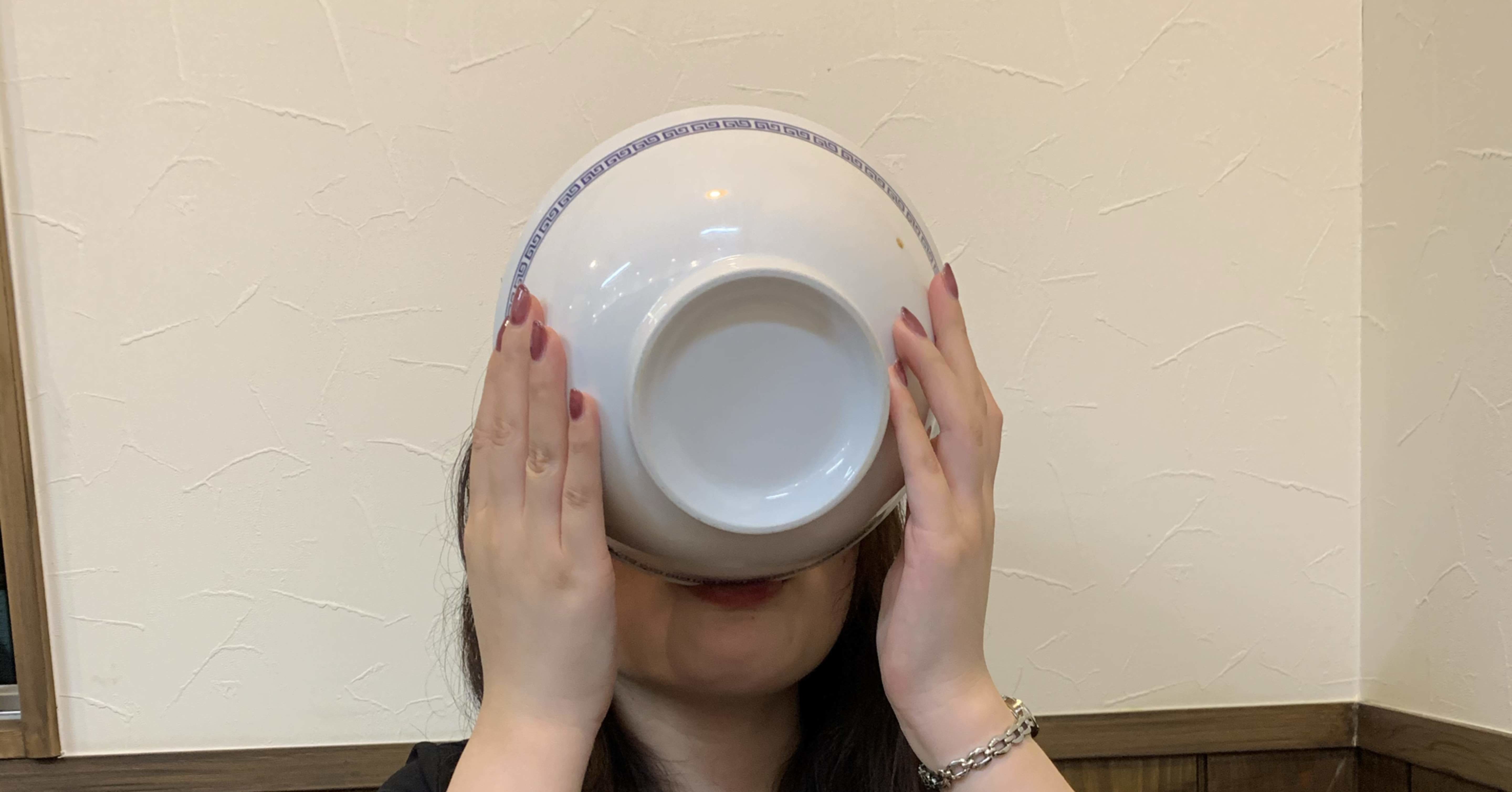 ラクダ アルツハイマー