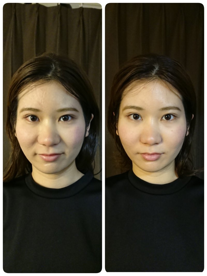 ビフォーアフター画像を元に小顔施術の解説 Briller Note