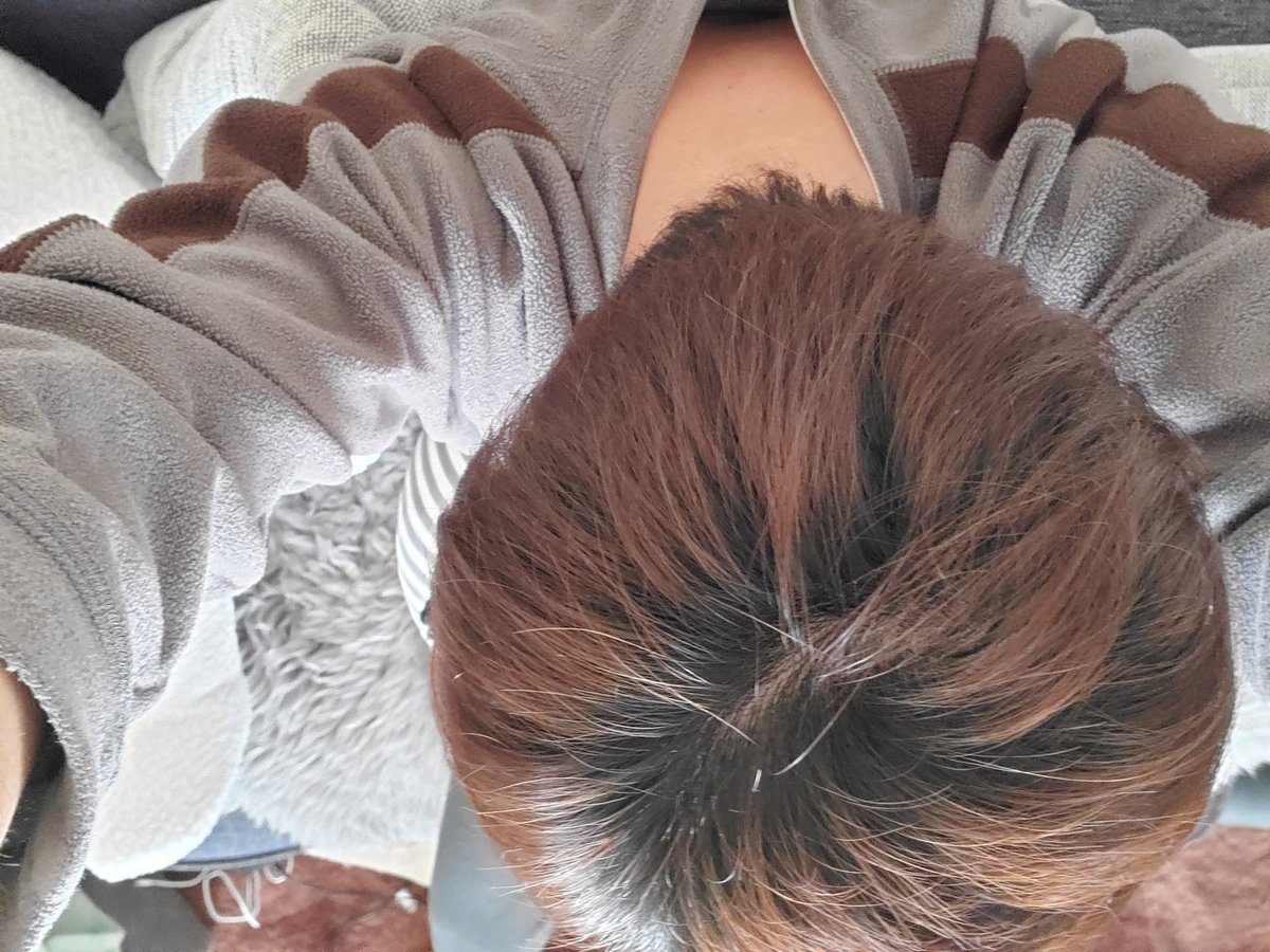 自分　頭頂部