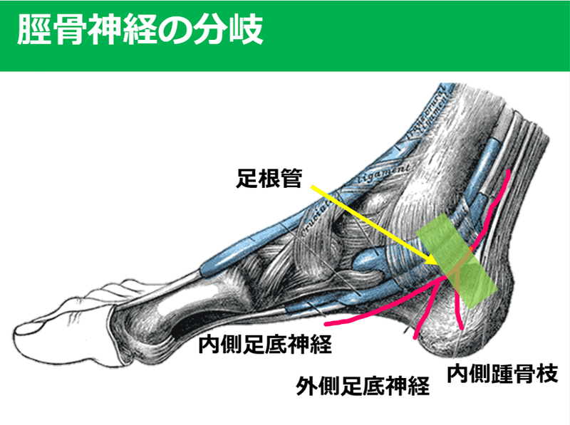 踵周辺の疼痛の見極め方 Part2 Y K Note 踵周辺の疼痛の見極め方 Part2 Y K Note