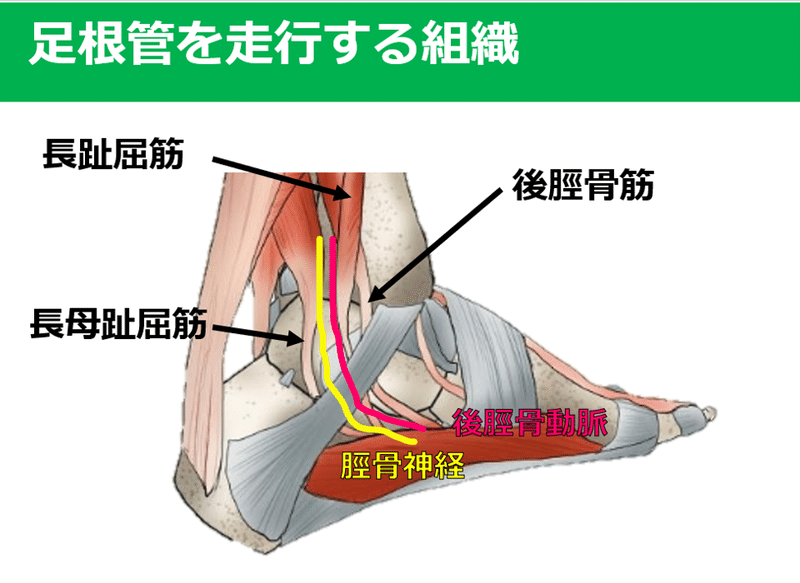 足根管症候群がわかる Y K Note