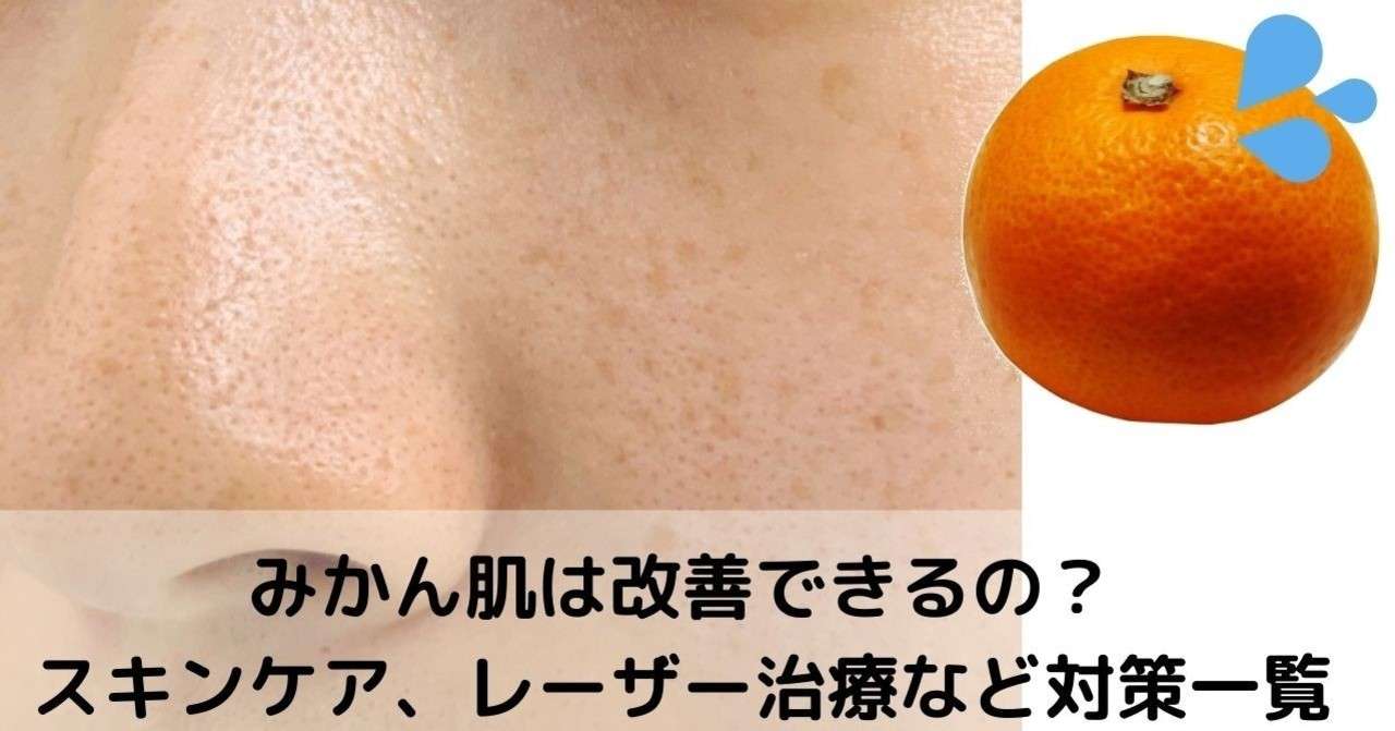 スタンド 観察する ミリメートル みかん 肌 ピーリング Joekirby Net