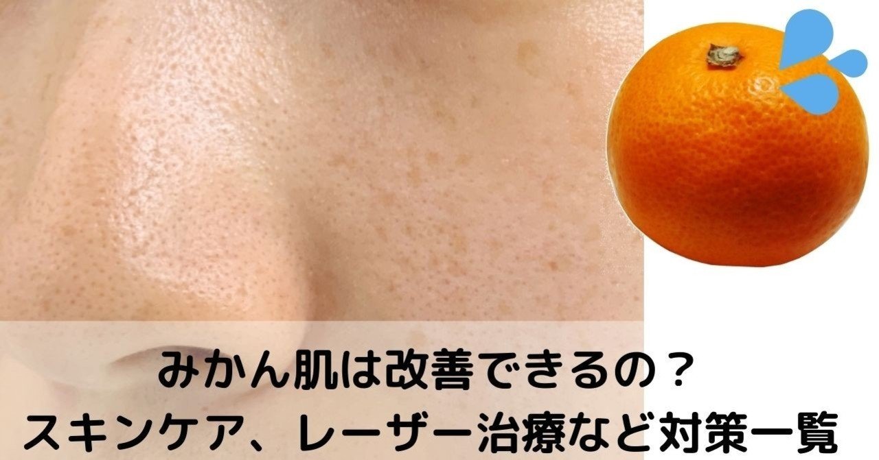 みかん肌の原因と改善方法 治るまでの期間は 美容ライターまめ Note