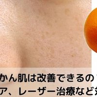 角栓抜いた後 毛穴がぽっかり 早く戻すにはどうしたらいいの 美容ライターまめ Note