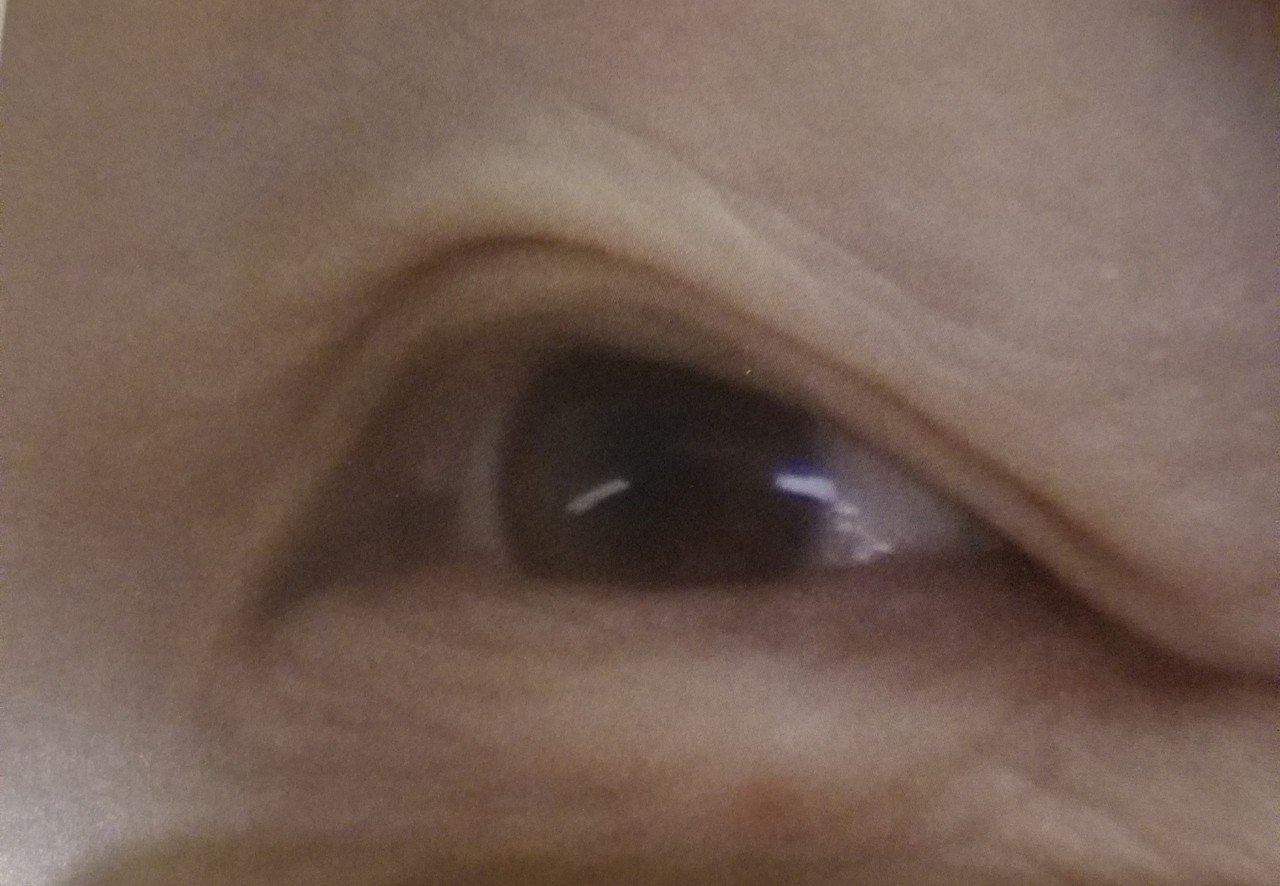 抗がん剤で抜けたまつ毛を取り戻す 暦の扉 Chie Yamanoi Note