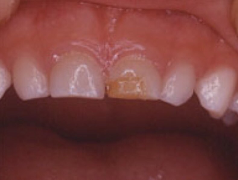 知っておいてほしい小児期の歯の知識と小児歯科専門医 子育て歯みがきレシピ Vol 8 子育て歯みがきレシピ Note