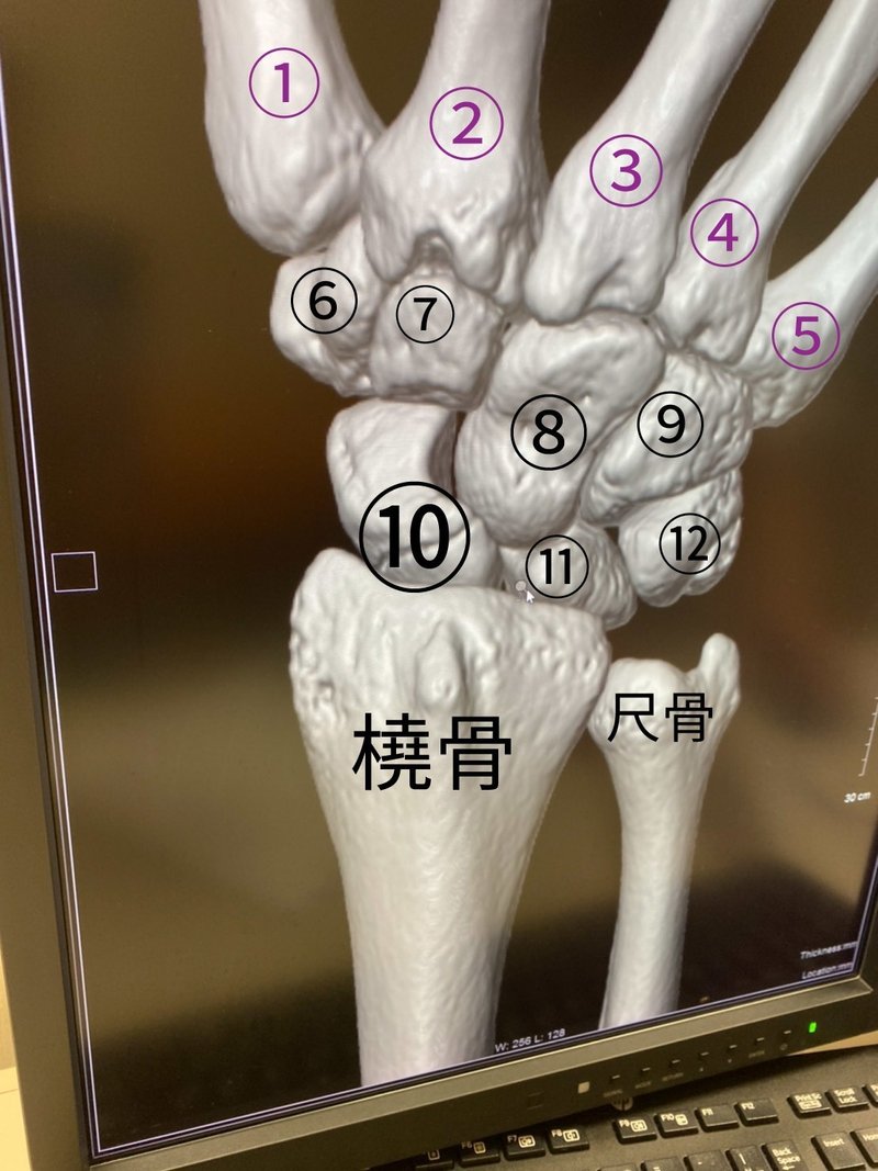舟状骨骨折 前編 Athlete Development Edge Note 舟状骨骨折 前編 Athlete Development Edge Note