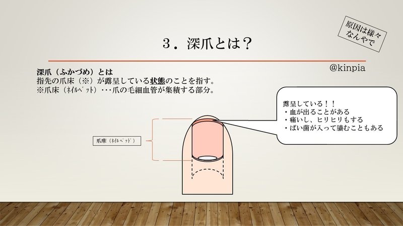 深爪克服 3 キンピア Note 深爪克服 3 キンピア Note