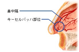 鼻血を出したい。【あんぱん】｜ヤニーズ