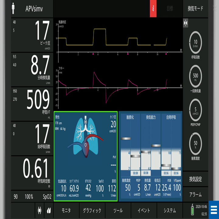 わかるまで解説する人工呼吸器②SIMVってなに？｜ムロ＠ケン