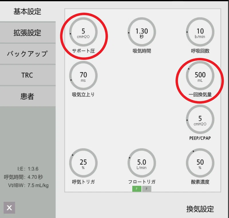 わかるまで解説する人工呼吸器②SIMVってなに？｜ムロ＠ケン
