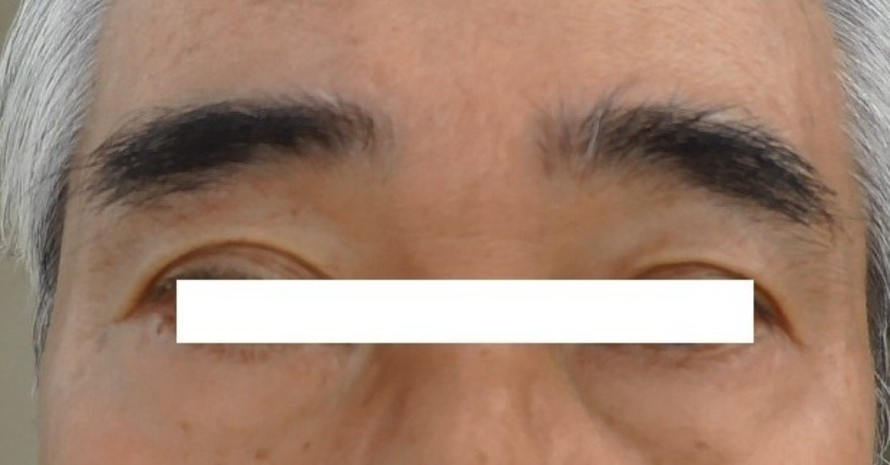 睾丸摘出 の新着タグ記事一覧 Note つくる つながる とどける