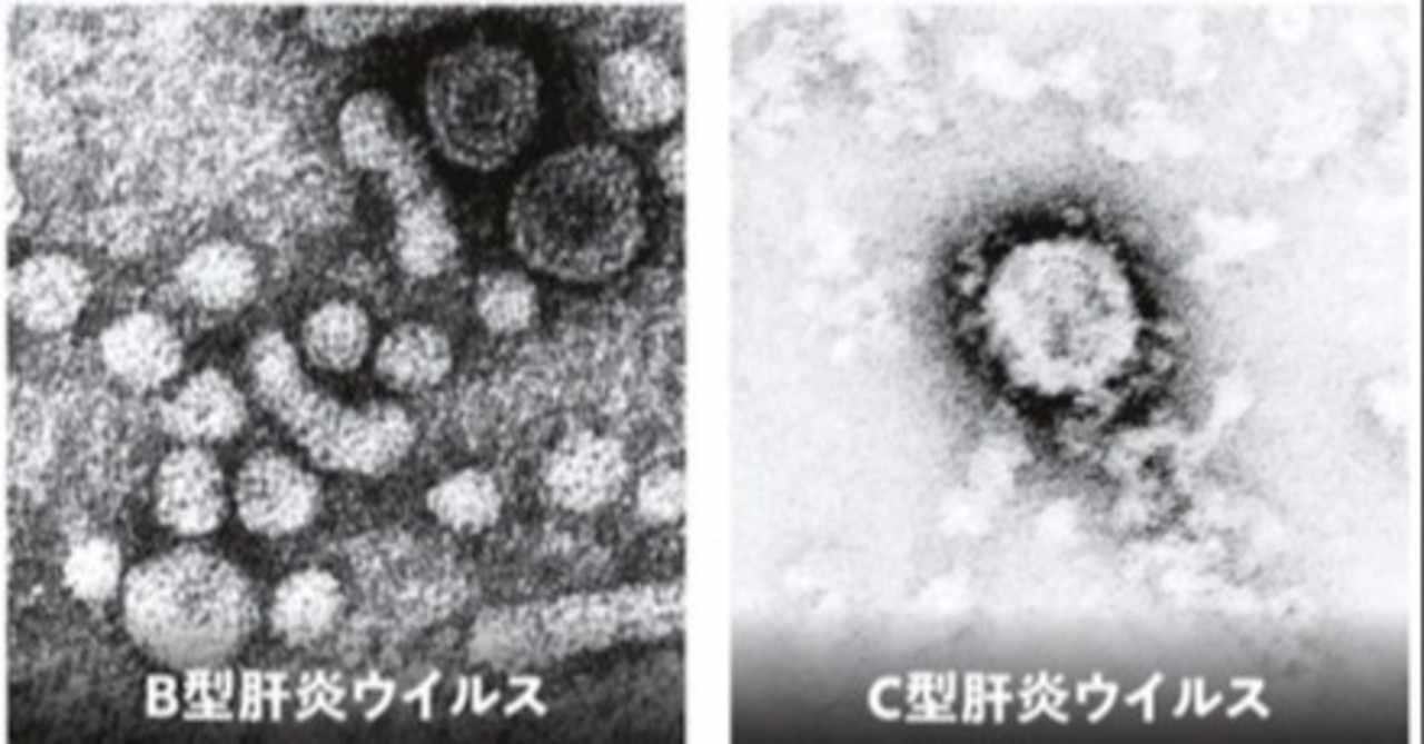 ノーベル医学生理学賞 C型肝炎ウイルスの発見 Masaki Note