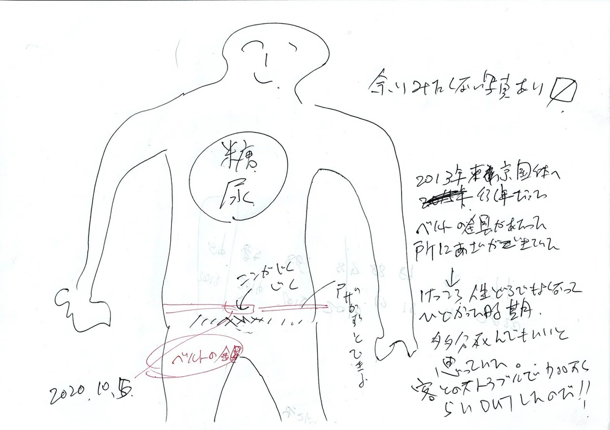 2013お腹アザ
