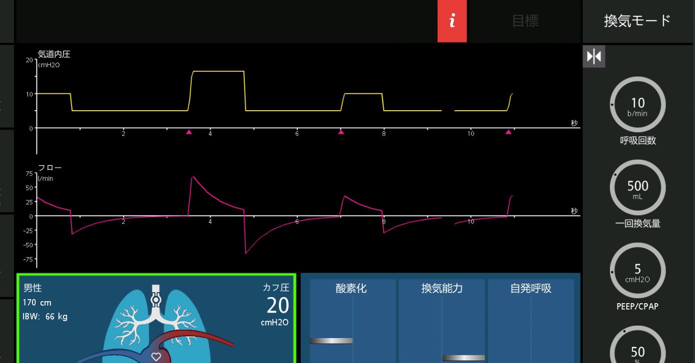 わかるまで解説する人工呼吸器②SIMVってなに？｜ムロ＠ケン
