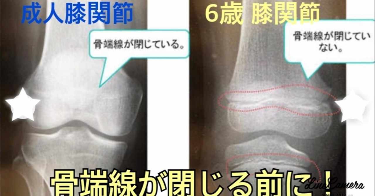 身長を伸ばす の新着タグ記事一覧 Note つくる つながる とどける