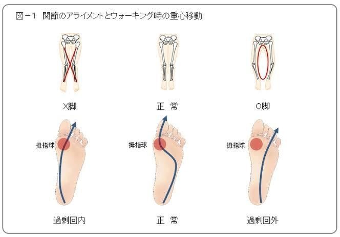 正しい歩き方という間違い 脳筋ですが介護に役立てたい Note