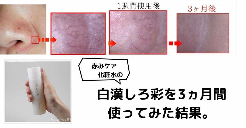 白漢しろ彩の使い方 3ヵ月で小鼻の赤みを消した使用法とは 美容ライターまめ Note