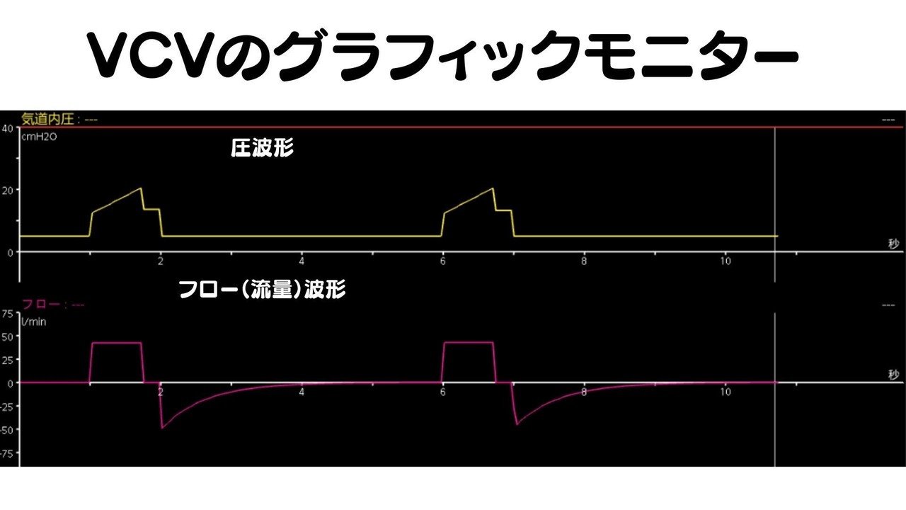 わかるまでずっと解説する人工呼吸器「そもそも非同調とはなにか