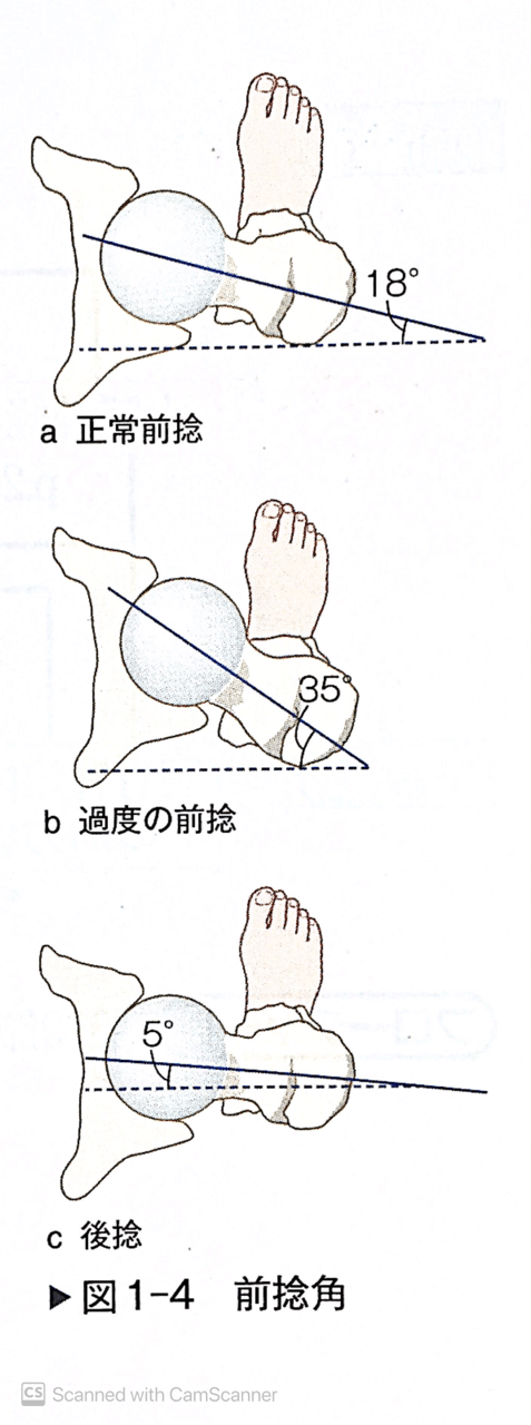 大腿骨近位部骨折に対する術後画像所見 レントゲン Ct 読影のチェックポイント 自分でできるボディワーク