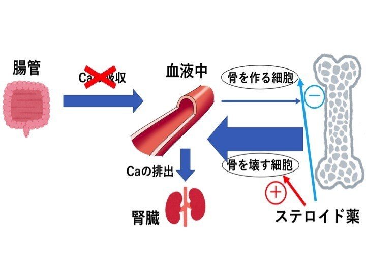 国試対策 ステロイドの副作用４つ のうと医療専門学校 Note