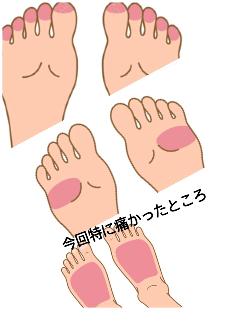 足裏にはたくさんツボがある 足裏 健康 第二の心臓 美容師えっちゅー Note 足裏にはたくさんツボがある 足裏 健康 第二の心臓 美容師えっちゅー Note