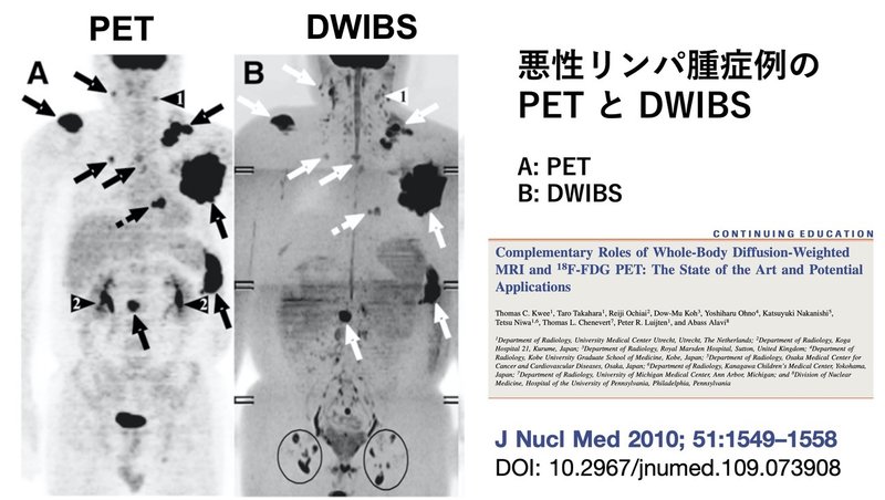 尿一滴の線虫検査で陽性になった人はどうすれば良いのか たろりん 高原太郎 Note 尿一滴の線虫検査で陽性になった人はどうすれば良いのか たろりん 高原太郎 Note