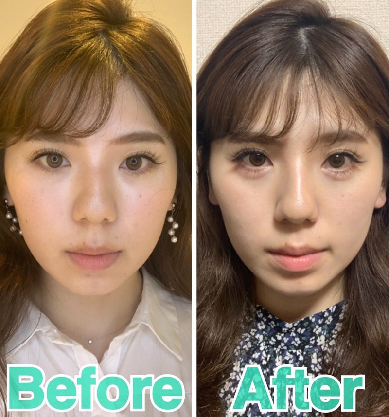 新型コロナウイルスをきっかけにプチ整形 美容医療 整形の口コミ予約アプリ トリビュー Note