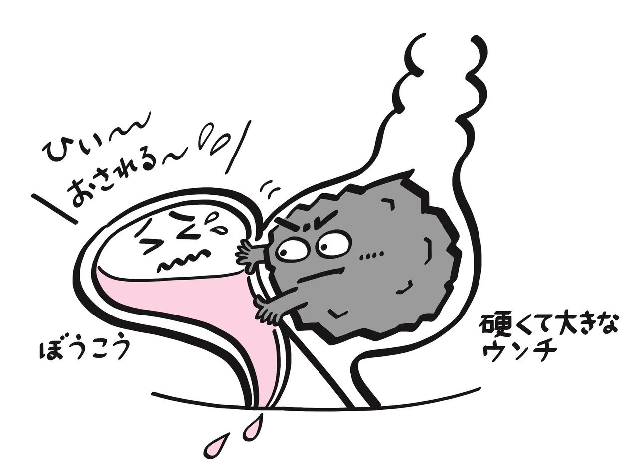 おねしょ の原因は 便秘 だったりする 小児科医のママ 工藤紀子 Note おねしょ の原因は 便秘 だったりする 小児科医のママ 工藤紀子 Note