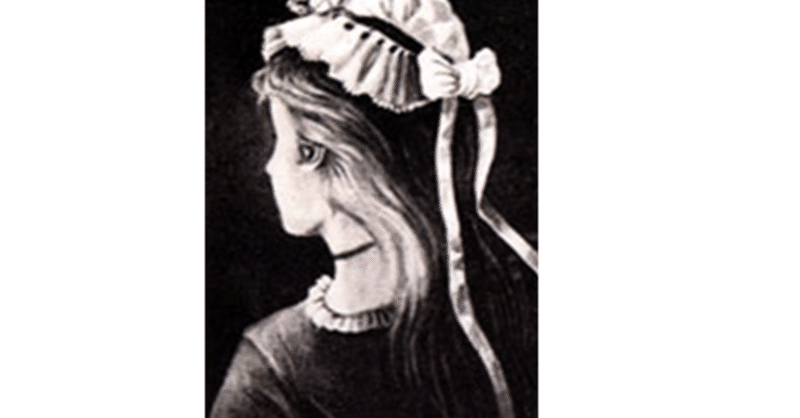 正体 アトピー素因 は隠し絵 だまし絵に埋もれていた 5 6 アトピーと発達障害 Hsp Note