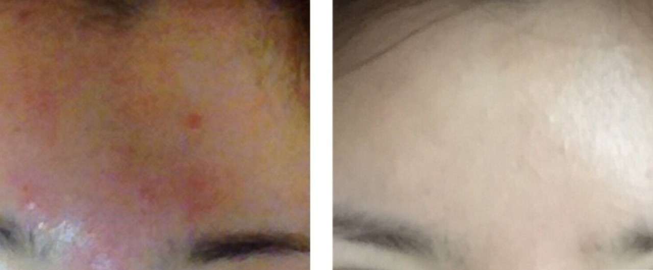 どんなに汚い肌でも美肌になる方法 整形微人 Note