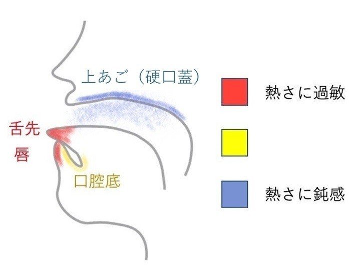 上あご（硬口蓋）