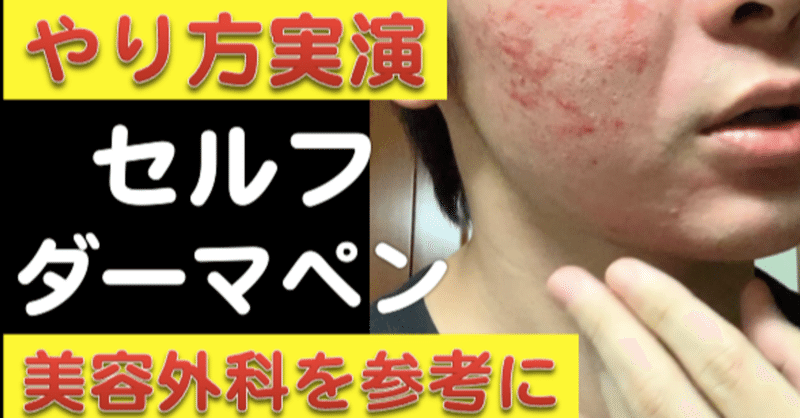 セルフダーマペン の新着タグ記事一覧 Note つくる つながる とどける