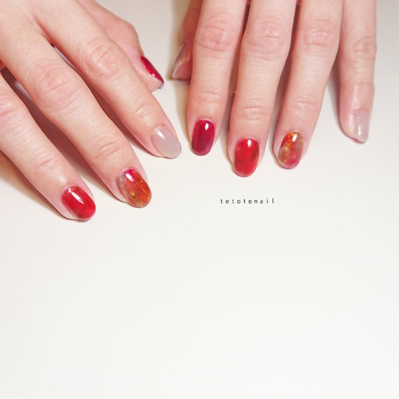 アトピーに悩むかたへ Tetotenail F Note アトピーに悩むかたへ Tetotenail F Note