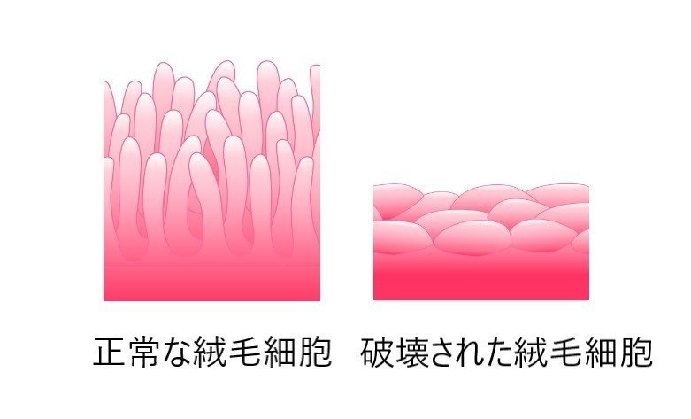 小腸絨毛細胞