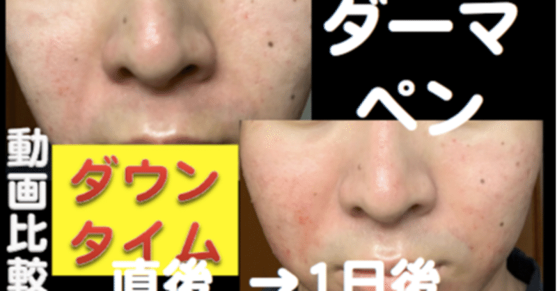 セルフダーマペン の新着タグ記事一覧 Note つくる つながる とどける